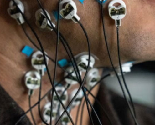 Close-up of a person’s neck and lower face with multiple small circular sensors attached to the skin, each connected by thin wires.