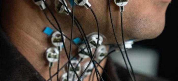 Close-up of a person’s neck and lower face with multiple small circular sensors attached to the skin, each connected by thin wires.