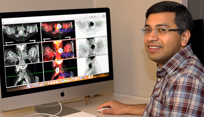 Abhijit Chaudhari, an associate professor in the UC Davis Department of Radiology, has received a DIAL grant to help commercialize a software plugin for medical imaging that can perform texture analysis and integrate seamlessly with OsiriX, one of the most widely-used medical image viewers in the world.