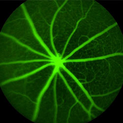 Ocular Cell Imaging